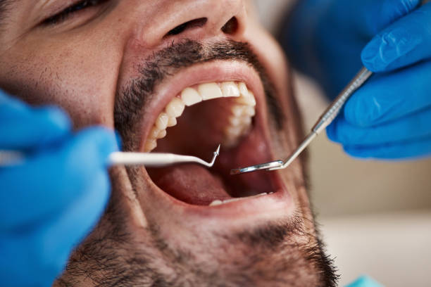 Best Emergency Dental Surgery in Amberley, OH